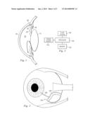 Reduction of Gas Escape in Membrane Actuators diagram and image