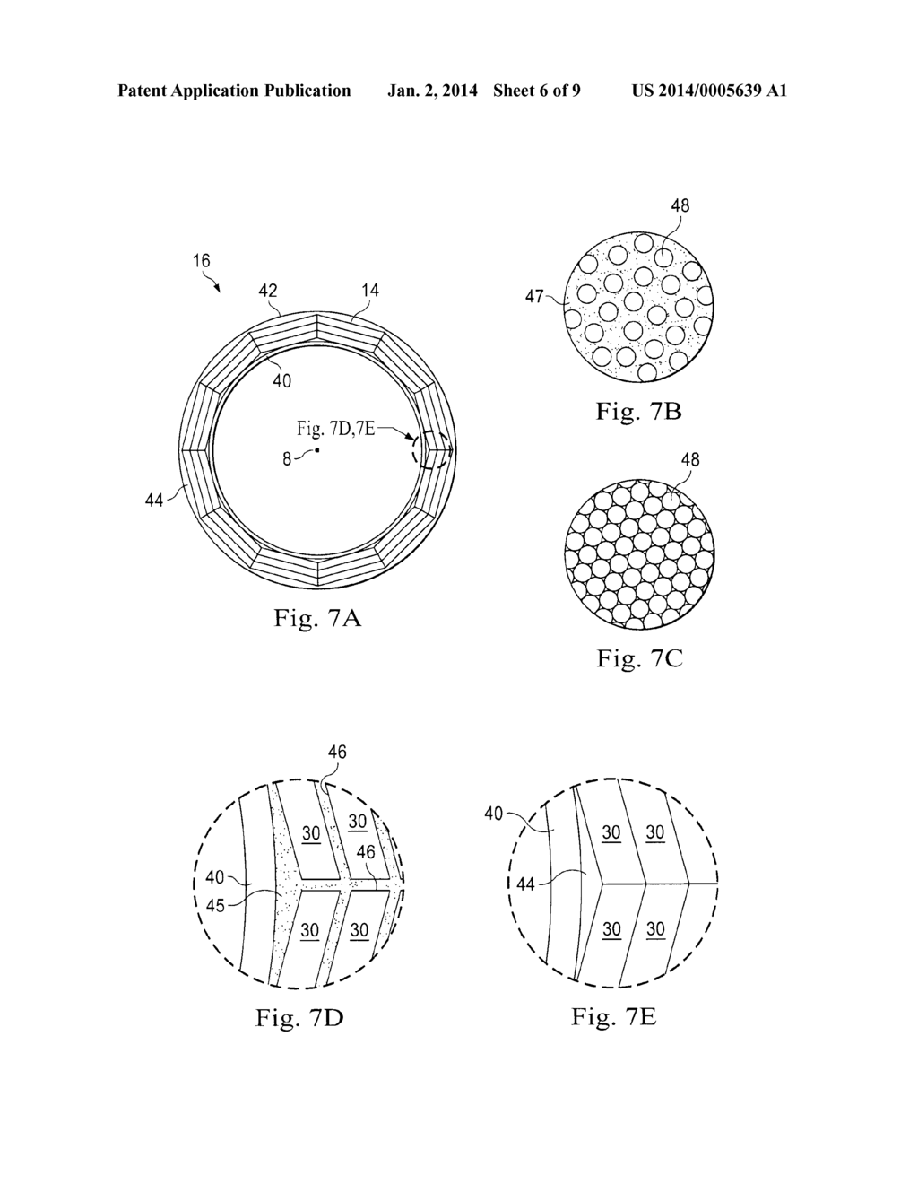 Stiffening Assembly - diagram, schematic, and image 07