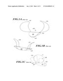 APPARATUS AND METHOD FOR POSITIONING AN IMPLANTABLE DEVICE diagram and image