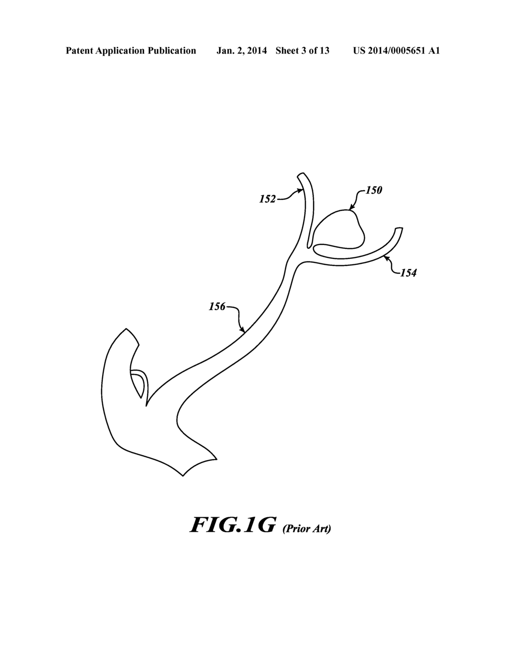 APPARATUS AND METHOD FOR POSITIONING AN IMPLANTABLE DEVICE - diagram, schematic, and image 04