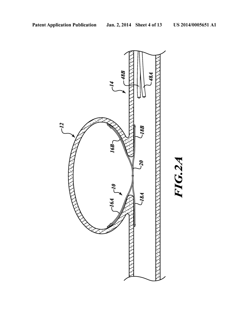 APPARATUS AND METHOD FOR POSITIONING AN IMPLANTABLE DEVICE - diagram, schematic, and image 05