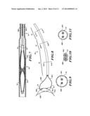 APPARATUS AND METHOD FOR POSITIONING AN IMPLANTABLE DEVICE diagram and image