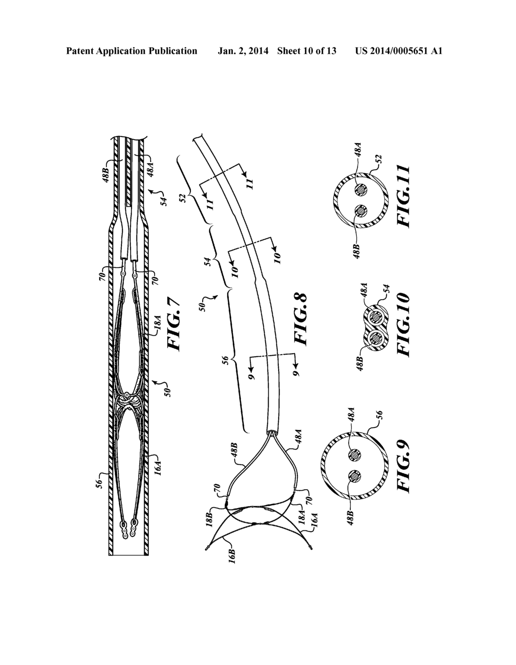 APPARATUS AND METHOD FOR POSITIONING AN IMPLANTABLE DEVICE - diagram, schematic, and image 11