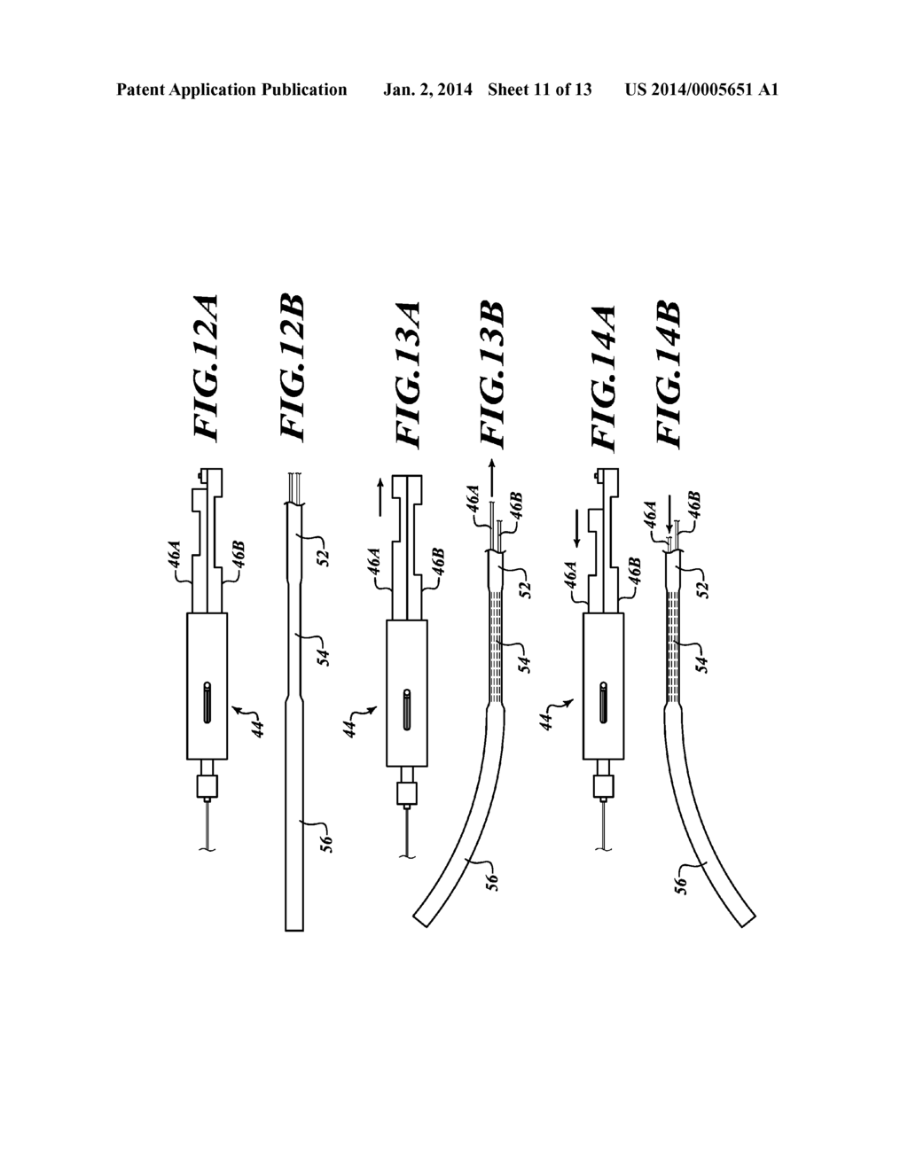 APPARATUS AND METHOD FOR POSITIONING AN IMPLANTABLE DEVICE - diagram, schematic, and image 12