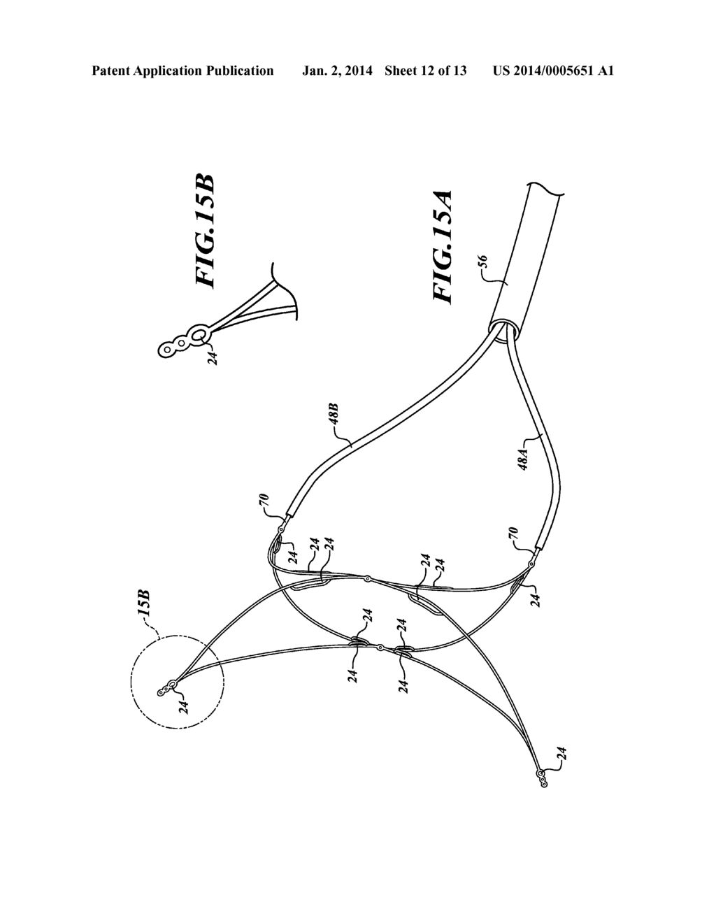 APPARATUS AND METHOD FOR POSITIONING AN IMPLANTABLE DEVICE - diagram, schematic, and image 13