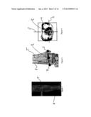 TOOL AND METHOD FOR DIGITAL ACQUISITION OF A TIBIAL MECHANICAL AXIS diagram and image