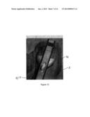 TOOL AND METHOD FOR DIGITAL ACQUISITION OF A TIBIAL MECHANICAL AXIS diagram and image