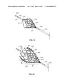 MULTI-LUMEN CENTRAL ACCESS VENA CAVA FILTER APPARATUS FOR CLOT MANAGEMENT     AND METHOD OF USING SAME diagram and image