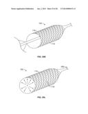 MULTI-LUMEN CENTRAL ACCESS VENA CAVA FILTER APPARATUS FOR CLOT MANAGEMENT     AND METHOD OF USING SAME diagram and image