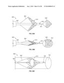 MULTI-LUMEN CENTRAL ACCESS VENA CAVA FILTER APPARATUS FOR CLOT MANAGEMENT     AND METHOD OF USING SAME diagram and image