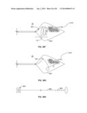 MULTI-LUMEN CENTRAL ACCESS VENA CAVA FILTER APPARATUS FOR CLOT MANAGEMENT     AND METHOD OF USING SAME diagram and image