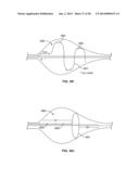 MULTI-LUMEN CENTRAL ACCESS VENA CAVA FILTER APPARATUS FOR CLOT MANAGEMENT     AND METHOD OF USING SAME diagram and image