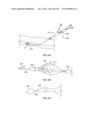 MULTI-LUMEN CENTRAL ACCESS VENA CAVA FILTER APPARATUS FOR CLOT MANAGEMENT     AND METHOD OF USING SAME diagram and image