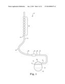 LEAD POSITIONING AND FINNED FIXATION SYSTEM diagram and image