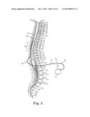 LEAD POSITIONING AND FINNED FIXATION SYSTEM diagram and image