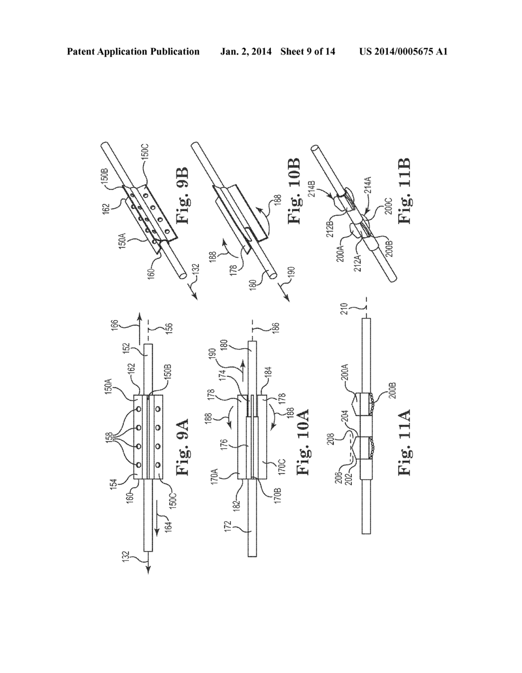 LEAD POSITIONING AND FINNED FIXATION SYSTEM - diagram, schematic, and image 10