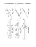 LEAD POSITIONING AND FINNED FIXATION SYSTEM diagram and image