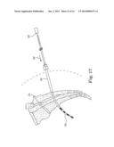 LEAD POSITIONING AND FINNED FIXATION SYSTEM diagram and image