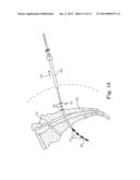 LEAD POSITIONING AND FINNED FIXATION SYSTEM diagram and image