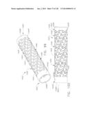 ROTARY ACTUATABLE CLOSURE ARRANGEMENT FOR SURGICAL END EFFECTOR diagram and image