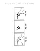 AUTOMATED SURGICAL AND INTERVENTIONAL PROCEDURES diagram and image