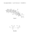 SURGICAL INSTRUMENTS WITH ARTICULATING SHAFTS diagram and image