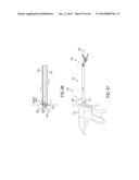 SURGICAL INSTRUMENTS WITH ARTICULATING SHAFTS diagram and image