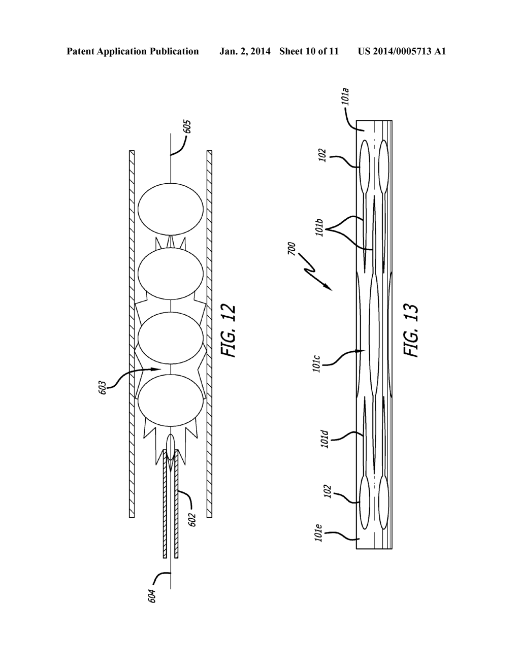 Obstruction Removal System - diagram, schematic, and image 11