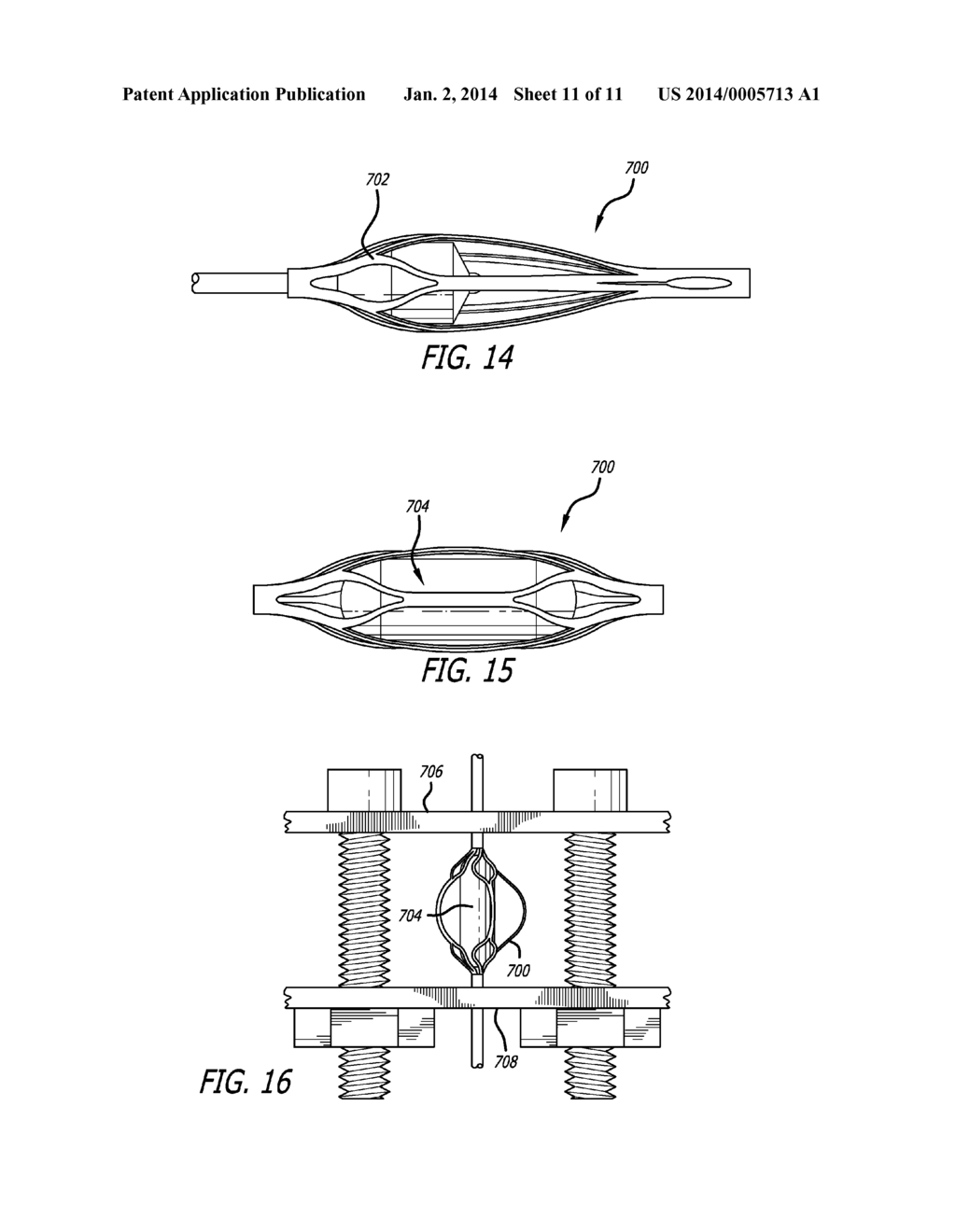 Obstruction Removal System - diagram, schematic, and image 12