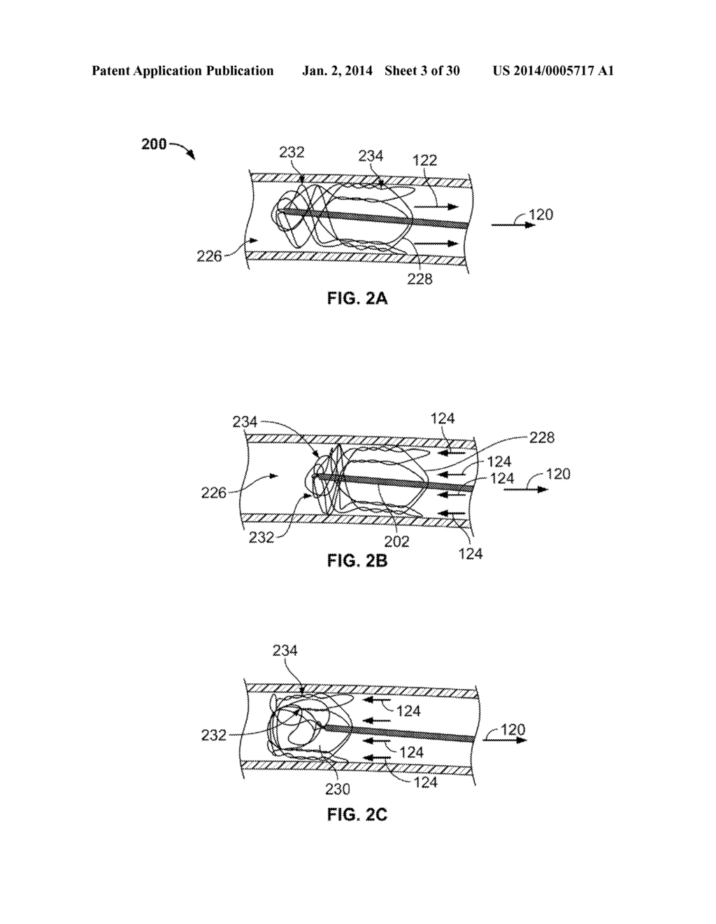 RETRIEVAL SYSTEMS AND METHODS FOR USE THEREOF - diagram, schematic, and image 04