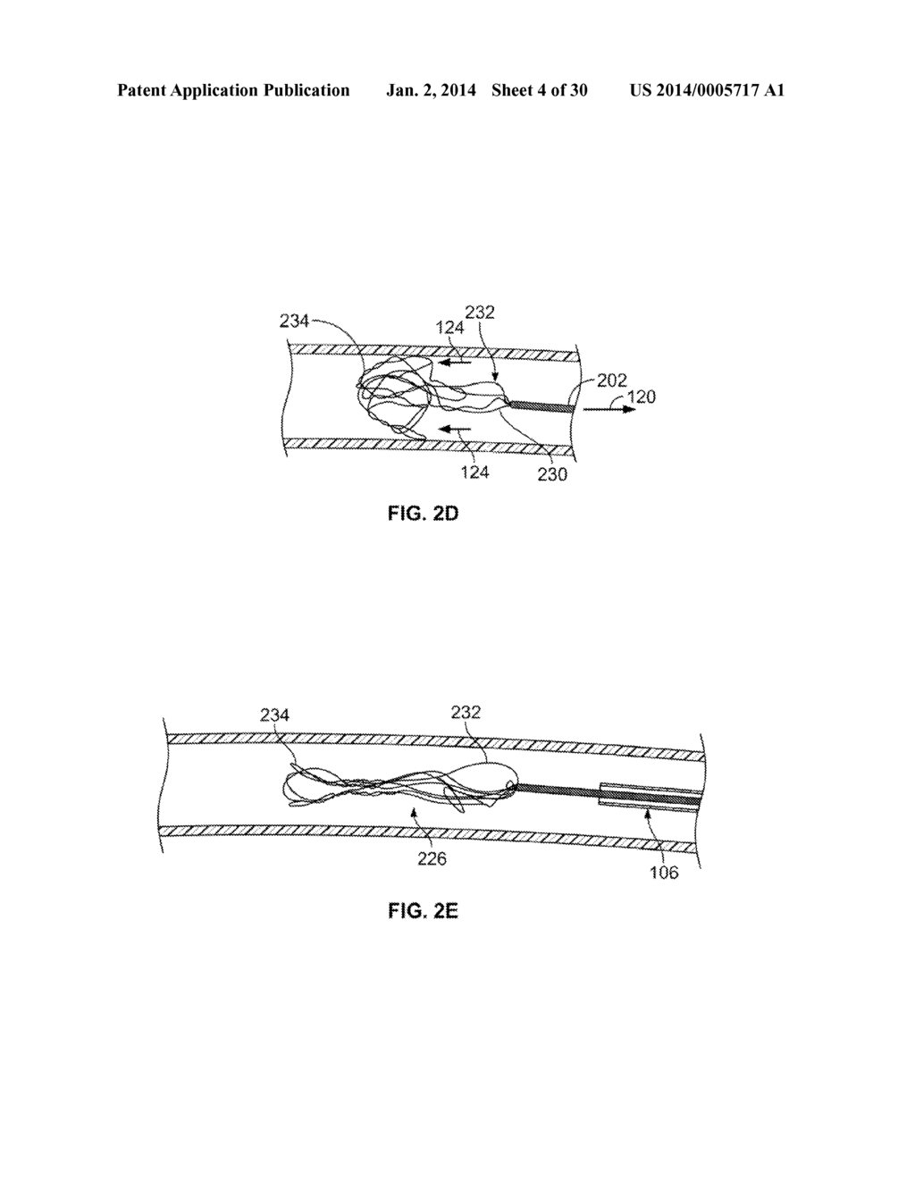 RETRIEVAL SYSTEMS AND METHODS FOR USE THEREOF - diagram, schematic, and image 05