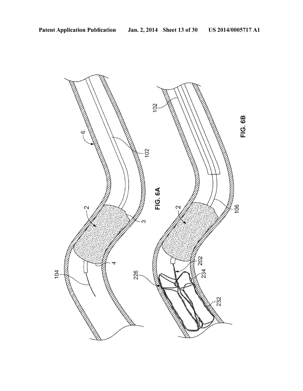 RETRIEVAL SYSTEMS AND METHODS FOR USE THEREOF - diagram, schematic, and image 14