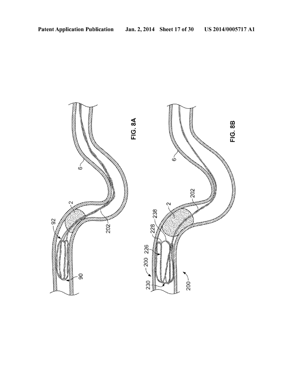 RETRIEVAL SYSTEMS AND METHODS FOR USE THEREOF - diagram, schematic, and image 18