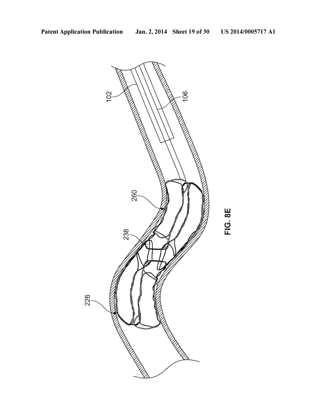 RETRIEVAL SYSTEMS AND METHODS FOR USE THEREOF - diagram, schematic, and image 20