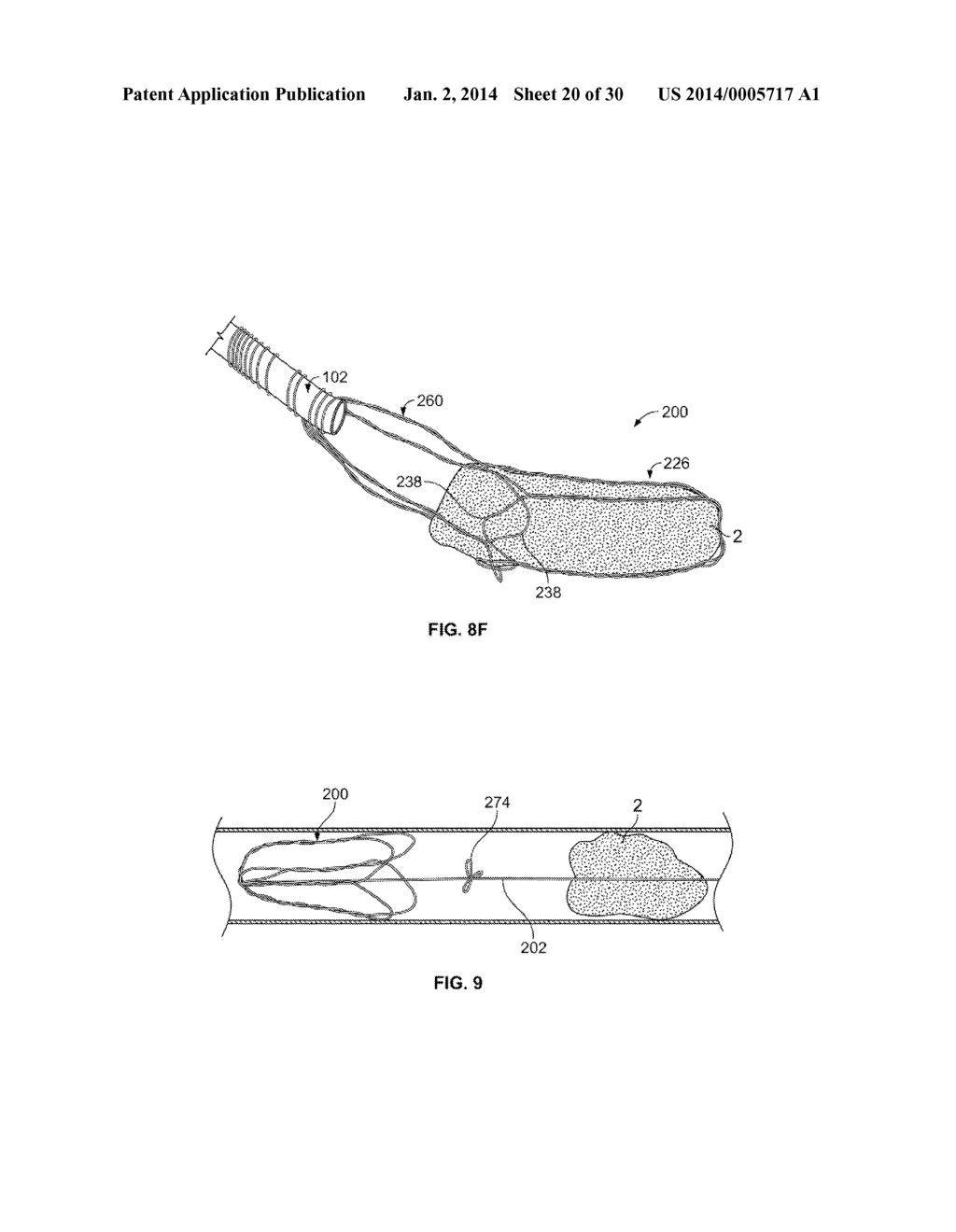 RETRIEVAL SYSTEMS AND METHODS FOR USE THEREOF - diagram, schematic, and image 21