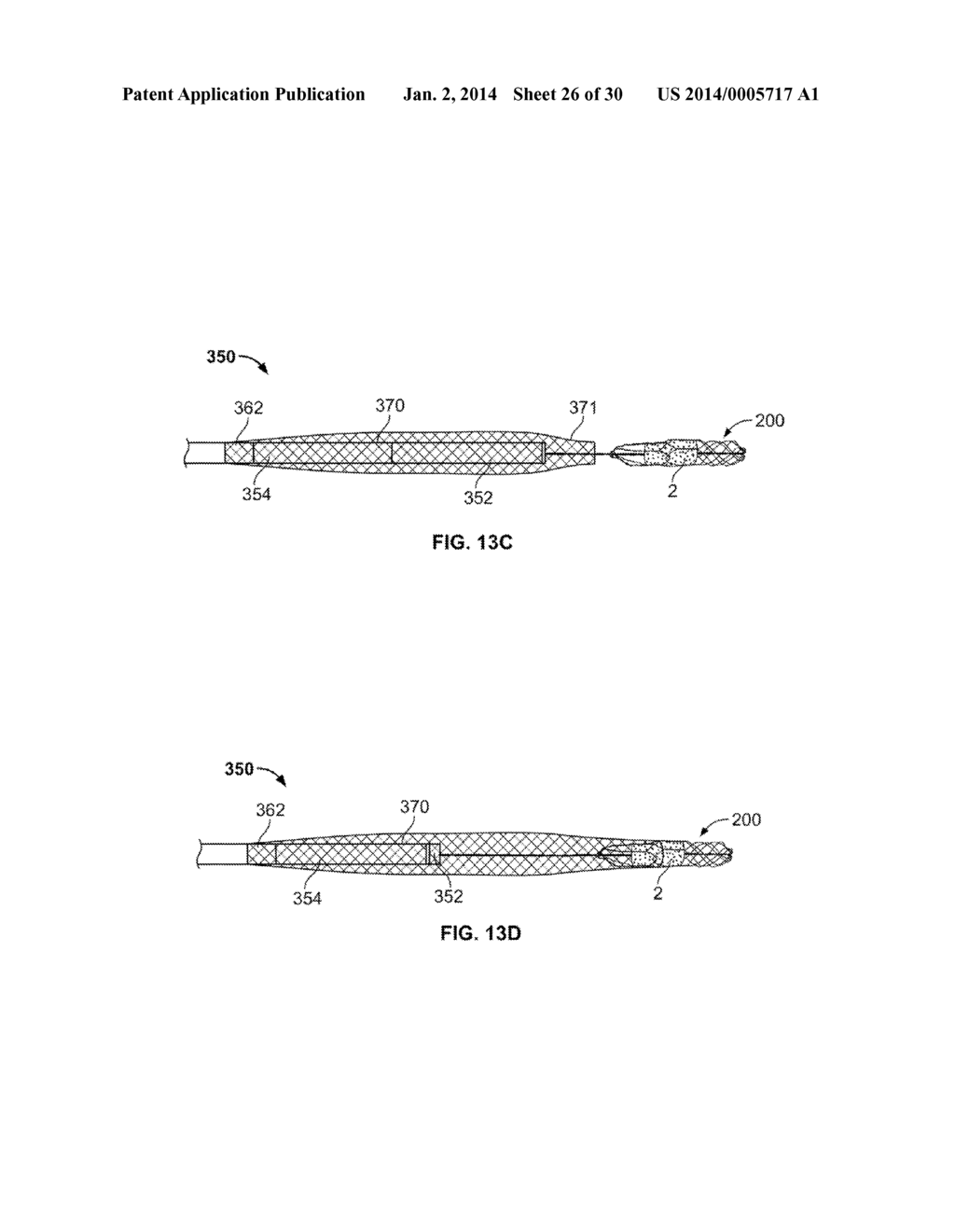 RETRIEVAL SYSTEMS AND METHODS FOR USE THEREOF - diagram, schematic, and image 27