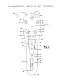 Proximal Humeral Head diagram and image