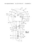 Proximal Humeral Head diagram and image