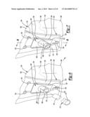 Proximal Humeral Head diagram and image