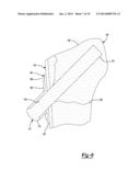 Proximal Humeral Head diagram and image