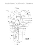 Proximal Humeral Head diagram and image