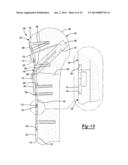 Proximal Humeral Head diagram and image