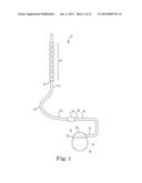 BRAIDED LEAD WITH EMBEDDED FIXATION STRUCTURES diagram and image