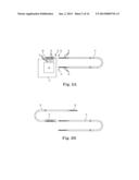 BRAIDED LEAD WITH EMBEDDED FIXATION STRUCTURES diagram and image