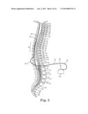 BRAIDED LEAD WITH EMBEDDED FIXATION STRUCTURES diagram and image