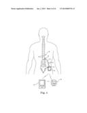 BRAIDED LEAD WITH EMBEDDED FIXATION STRUCTURES diagram and image