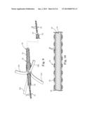 BRAIDED LEAD WITH EMBEDDED FIXATION STRUCTURES diagram and image