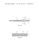 BRAIDED LEAD WITH EMBEDDED FIXATION STRUCTURES diagram and image