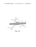 BRAIDED LEAD WITH EMBEDDED FIXATION STRUCTURES diagram and image