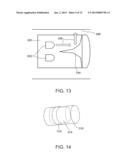 CAPSULE PHOTOTHERAPY diagram and image